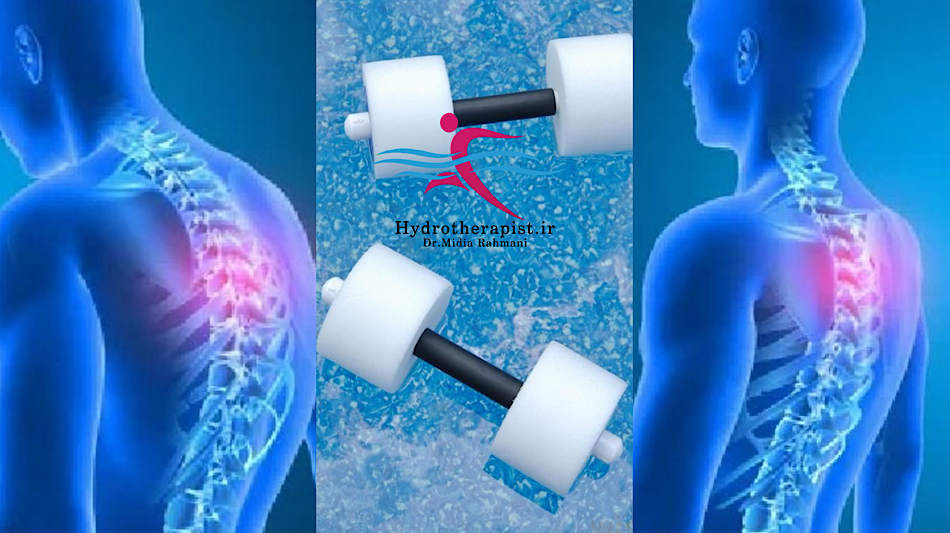 کایفوزیس (Kyphosis) و نقش آبدرمانی در بهبود آن